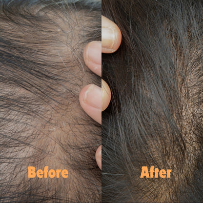 5W HAIR GROWTH SERUM | 55 ml. |  Initial results in 5 Weeks  | Hair volume booster